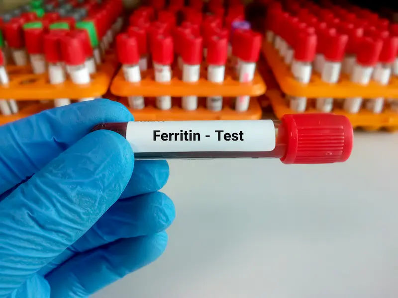 Ferritin Test Overview and Process